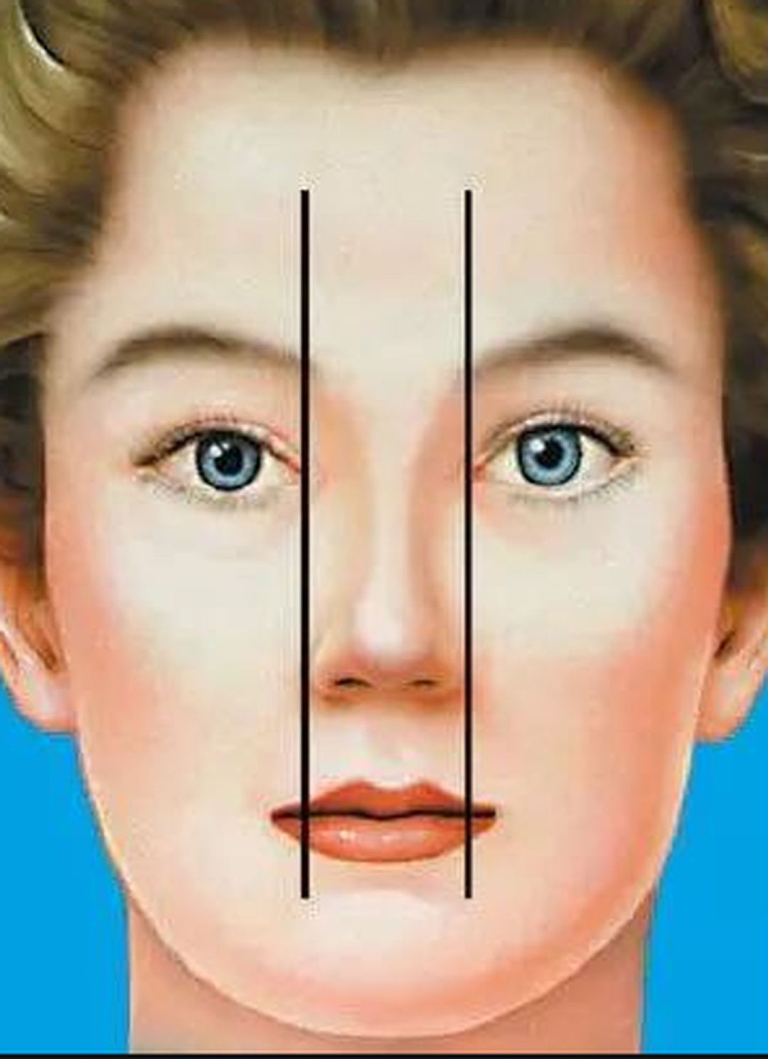 隆鼻之后都会遇到哪些问题？隆鼻假体可以管多少年？(图1)